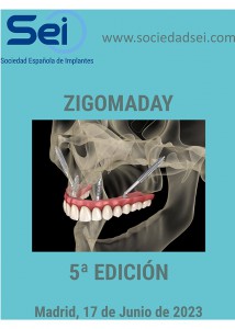 SEI-ZigomaDay5---Poster-1
