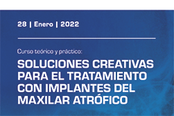 newsletter-Soluciones-creativas-SEIr-2022